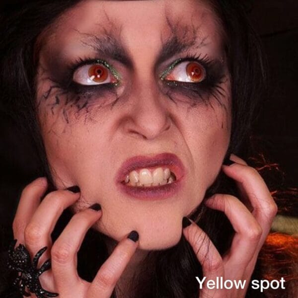 Yellow Spot - Imagem 2