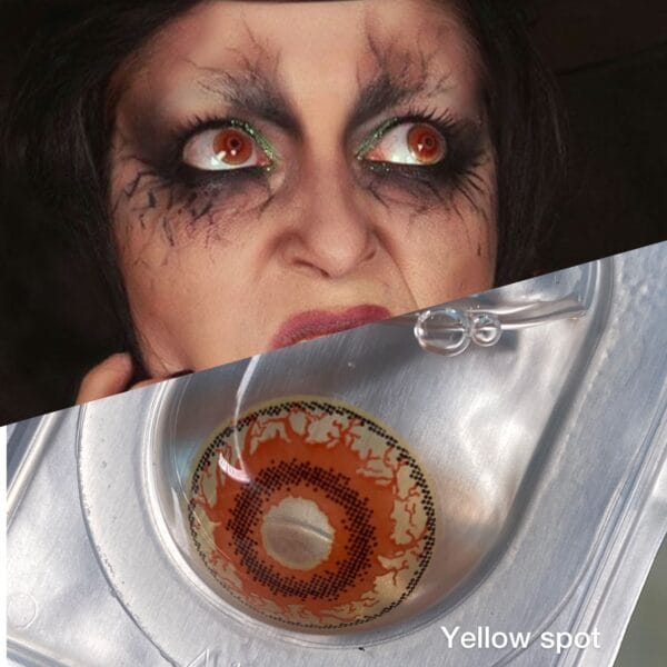 Yellow Spot - Imagem 3