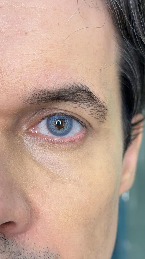 Maldivas Blue - Imagem 8